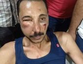 إيقاف ضابط شرطه عن العمل بعد تعديه بالضرب علي محامي | صوت مصر نيوز